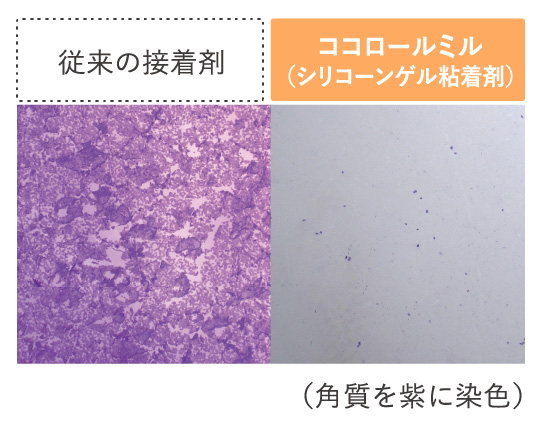 肌トラブルを起こしにくい、独自開発の粘着剤。はがした際にも粘着力が落ちにくいので、貼り直しも可能。