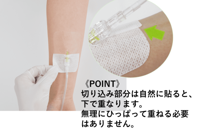 末梢静脈カテーテル固定フィルムのわかりやすい貼り方【エアウォールIV切り込みタイプ】の画像